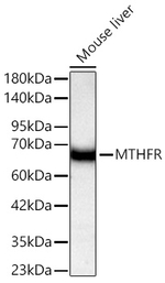 MTHFR Antibody in Western Blot (WB)
