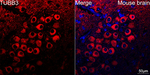 Beta III Tubulin Recombinant Rabbit Monoclonal Antibody (9H6W10)