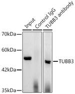 Beta III Tubulin Antibody in Immunoprecipitation (IP)