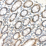 PCIF1 Antibody in Immunohistochemistry (Paraffin) (IHC (P))