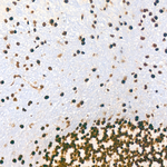 PCIF1 Antibody in Immunohistochemistry (Paraffin) (IHC (P))