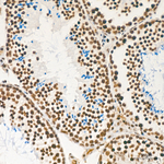 PCIF1 Antibody in Immunohistochemistry (Paraffin) (IHC (P))