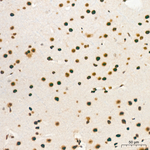 PCIF1 Antibody in Immunohistochemistry (Paraffin) (IHC (P))