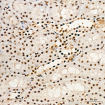 PCIF1 Antibody in Immunohistochemistry (Paraffin) (IHC (P))