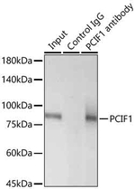 PCIF1 Antibody in Immunoprecipitation (IP)