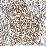 DCK Antibody in Immunohistochemistry (Paraffin) (IHC (P))
