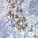 DCK Recombinant Rabbit Monoclonal Antibody (5Q7D0)