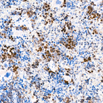 DCK Antibody in Immunohistochemistry (Paraffin) (IHC (P))