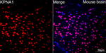 KPNA1 Antibody in Immunohistochemistry (Paraffin) (IHC (P))