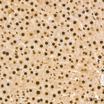 KPNA1 Antibody in Immunohistochemistry (Paraffin) (IHC (P))