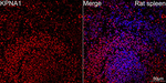 KPNA1 Antibody in Immunohistochemistry (Paraffin) (IHC (P))