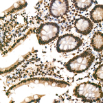 KPNA1 Antibody in Immunohistochemistry (Paraffin) (IHC (P))