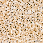 KPNA1 Antibody in Immunohistochemistry (Paraffin) (IHC (P))