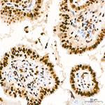 KPNA1 Antibody in Immunohistochemistry (Paraffin) (IHC (P))