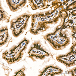 KPNA1 Antibody in Immunohistochemistry (Paraffin) (IHC (P))