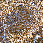 KPNA1 Antibody in Immunohistochemistry (Paraffin) (IHC (P))