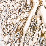 KPNA1 Antibody in Immunohistochemistry (Paraffin) (IHC (P))