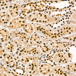 KPNA1 Antibody in Immunohistochemistry (Paraffin) (IHC (P))