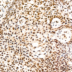 LSD1 Antibody in Immunohistochemistry (Paraffin) (IHC (P))