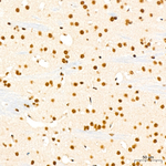 LSD1 Antibody in Immunohistochemistry (Paraffin) (IHC (P))