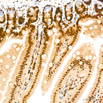 LSD1 Antibody in Immunohistochemistry (Paraffin) (IHC (P))