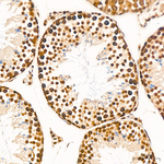 LSD1 Antibody in Immunohistochemistry (Paraffin) (IHC (P))