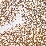 LSD1 Antibody in Immunohistochemistry (Paraffin) (IHC (P))