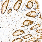 LSD1 Antibody in Immunohistochemistry (Paraffin) (IHC (P))