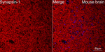 Synapsin 1 Recombinant Rabbit Monoclonal Antibody (3Y2B3)