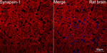 Synapsin 1 Antibody in Immunohistochemistry (Paraffin) (IHC (P))