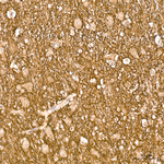 Synapsin 1 Antibody in Immunohistochemistry (Paraffin) (IHC (P))