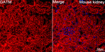GATM Recombinant Rabbit Monoclonal Antibody (1V2V4)