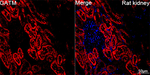 GATM Antibody in Immunohistochemistry (Paraffin) (IHC (P))
