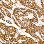 GATM Antibody in Immunohistochemistry (Paraffin) (IHC (P))