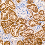 GATM Antibody in Immunohistochemistry (Paraffin) (IHC (P))