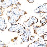 hCG beta Antibody in Immunohistochemistry (Paraffin) (IHC (P))