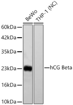 hCG beta Antibody in Western Blot (WB)