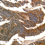 CD9 Antibody in Immunohistochemistry (Paraffin) (IHC (P))