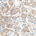 CD9 Antibody in Immunohistochemistry (Paraffin) (IHC (P))