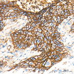CD9 Antibody in Immunohistochemistry (Paraffin) (IHC (P))