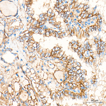 CD9 Antibody in Immunohistochemistry (Paraffin) (IHC (P))