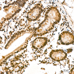 NSUN2 Antibody in Immunohistochemistry (Paraffin) (IHC (P))