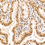NSUN2 Antibody in Immunohistochemistry (Paraffin) (IHC (P))
