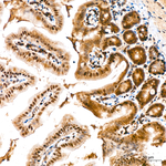 NSUN2 Antibody in Immunohistochemistry (Paraffin) (IHC (P))