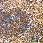 NSUN2 Antibody in Immunohistochemistry (Paraffin) (IHC (P))