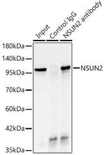 NSUN2 Antibody in Immunoprecipitation (IP)