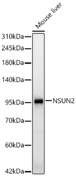 NSUN2 Antibody in Western Blot (WB)