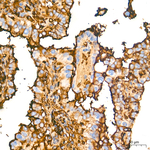 Albumin Antibody in Immunohistochemistry (Paraffin) (IHC (P))