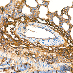 Albumin Antibody in Immunohistochemistry (Paraffin) (IHC (P))
