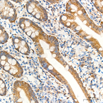PYCARD Antibody in Immunohistochemistry (Paraffin) (IHC (P))